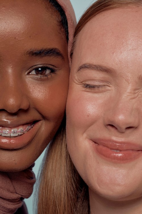 Twee vrouwen dicht bij elkaar, glimlachend, een met beugel, gezichten tegen elkaar gedrukt.