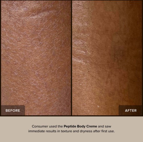 Iho näyttää sileämmältä ja kosteutetummalta Peptide Body Creme -käytön jälkeen.