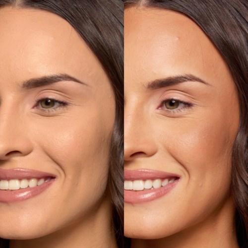 Nebeneinander Fotos einer Frau, die verbessert Haut und ein strahlenderes Lächeln nach Make-up zeigt.