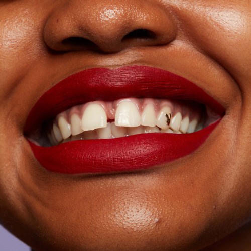 Close-up of a person's smile showing missing teeth, red lipstick, and a small gold tooth cap.