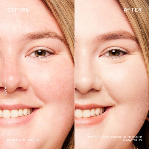 Vergleich zeigt klare Haut vor und glatte Haut nach Concealer. Lächelnde Frau mit Sommersprossen und glatter Haut.