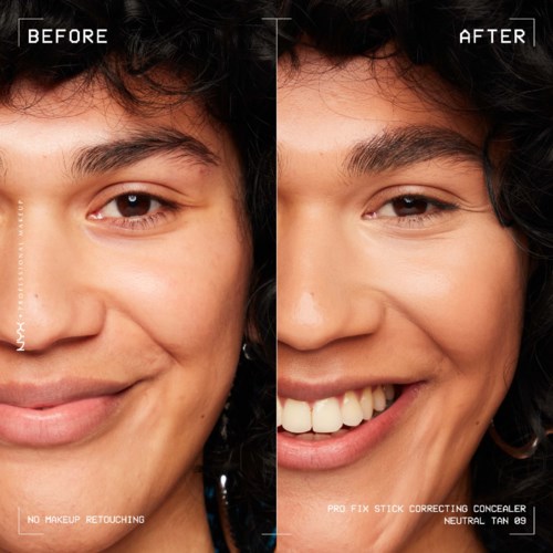 Bild zeigt Vorher-Nachher mit klarer Haut und hellem Lächeln. Kein Make-up, natürlicher Look, selbstbewusstes Ausdruck.