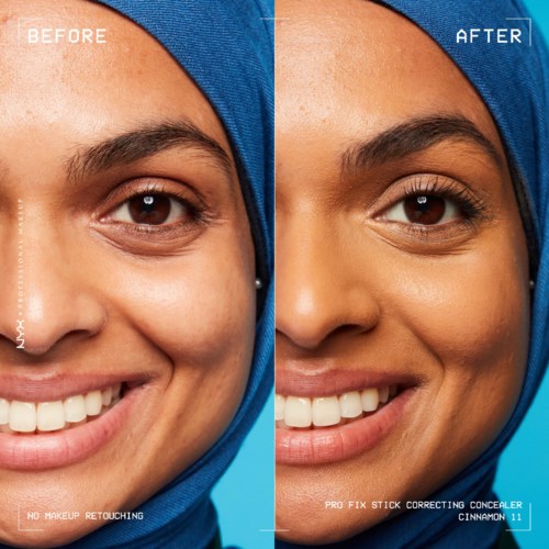 Vergleich mit Vorher- und Nachher-Bilder, die eine geglättete, hellere Haut um die Augen zeigen.