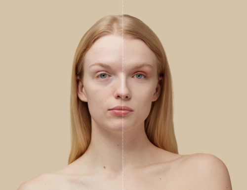 A woman shows a side-by-side difference in her skin, with one side clearer and smoother than the other.