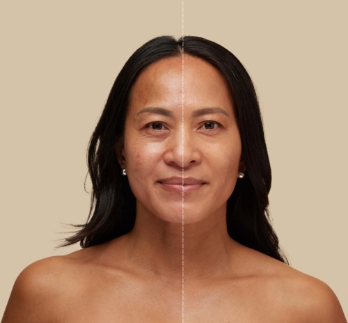 Eine Frau zeigt Seite-zu-Seite Vorher-Nachher-Bild ihrer Hautpflege, mit klarer Haut und kleinen Unterschieden.