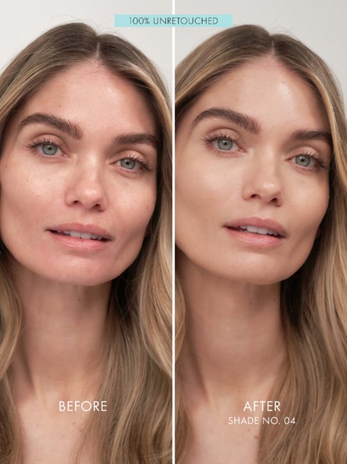 A woman with clear skin and light hair, showing before and after skin treatment improvement.
