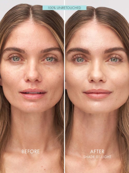 A woman shows clear skin improvement in a side-by-side photo, labeled before and after using a light shade product.