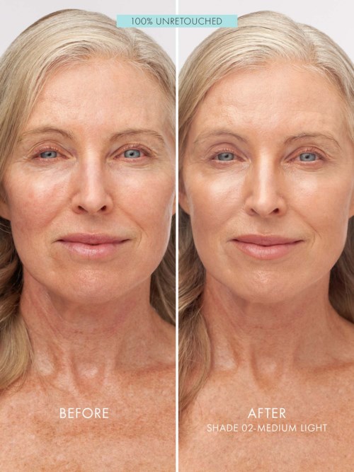 A woman shows smoother skin and fewer wrinkles after using a product, labeled 'before' and 'after' for comparison.
