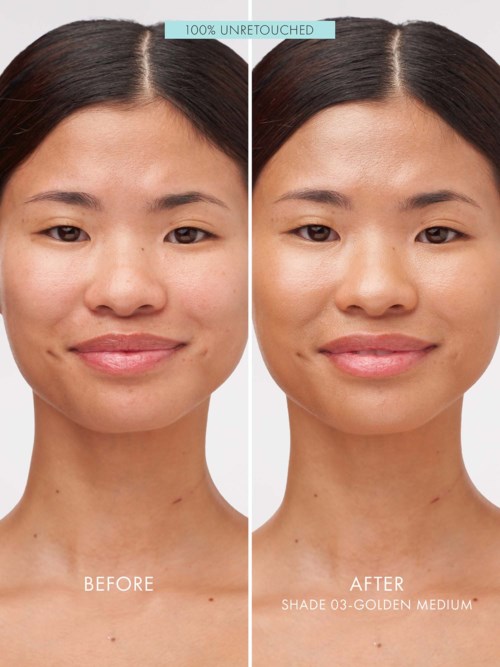 Side-by-side photos show a woman's face before and after using a product for skin improvement.
