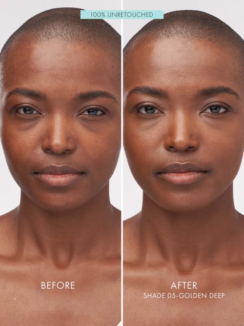 A woman shows a clear skin improvement in a before and after skincare photo. The after photo is labeled with product details.