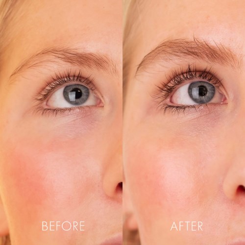 A girl shows a close-up of her face before and after skincare, highlighting clearer skin and brighter eyes.