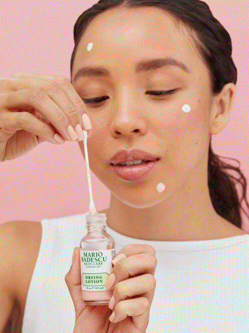 En kvinna med vita fläckar i ansiktet applicerar lotion från en flaska med en pipette.
